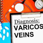 Cosmetic vs. Medical Treatment for Varicose Veins