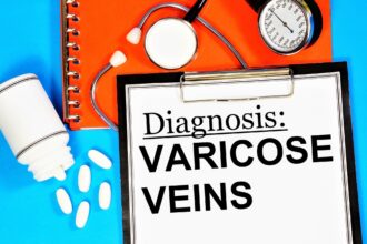 Cosmetic vs. Medical Treatment for Varicose Veins
