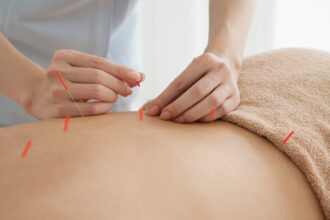 Using Acupuncture to Boost the Immune System