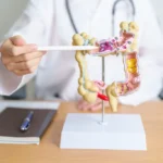 Advantages of Choosing Gastric Sleeve Over Other Procedures