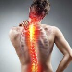 Benefits of Minimally Invasive Surgery for Spine Conditions