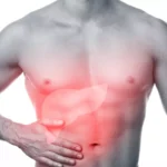 Dietary Adjustments To Make After Gallbladder Surgery