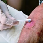 Effective Strategies for Wound Care Management