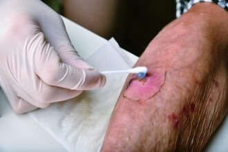 Effective Strategies for Wound Care Management
