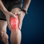 How Arthritis Affects Joint Mobility and Quality of Life