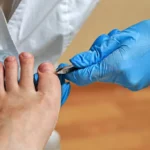 How Podiatrists Diagnose and Treat Foot Conditions