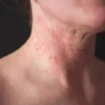 How a Skin Doctor Approaches Skin Allergies and Irritations