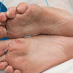 How to Find the Right Podiatrist for Your Foot Health Needs