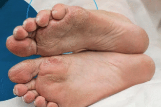 How to Find the Right Podiatrist for Your Foot Health Needs