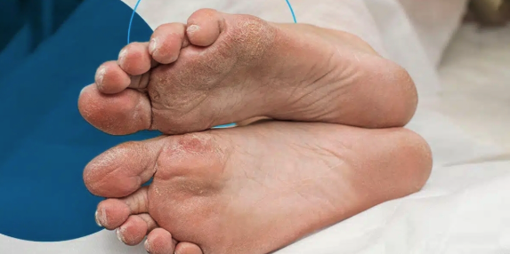 How to Find the Right Podiatrist for Your Foot Health Needs