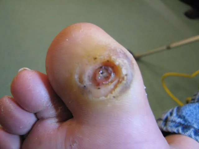 Innovative Techniques in Wound Care for Faster Recovery