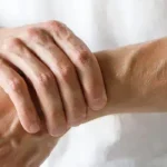 Natural Remedies and Lifestyle Changes for Managing Arthritis
