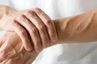 Natural Remedies and Lifestyle Changes for Managing Arthritis
