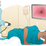 Navigating the Process of Getting a Colonoscopy