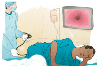 Navigating the Process of Getting a Colonoscopy