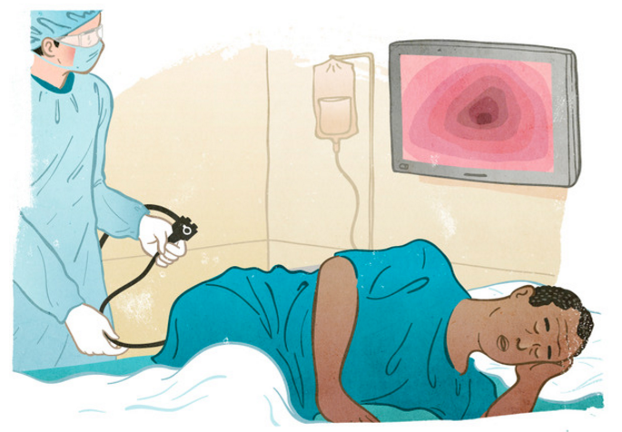 Navigating the Process of Getting a Colonoscopy