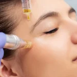 PRP Injections: A Revolutionary Approach to Skin Rejuvenation