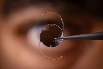 Preparing for Your Cataract Surgery Consultation
