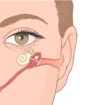 Reasons To Schedule a Balloon Sinuplasty Treatment