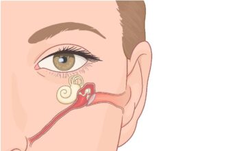 Reasons To Schedule a Balloon Sinuplasty Treatment