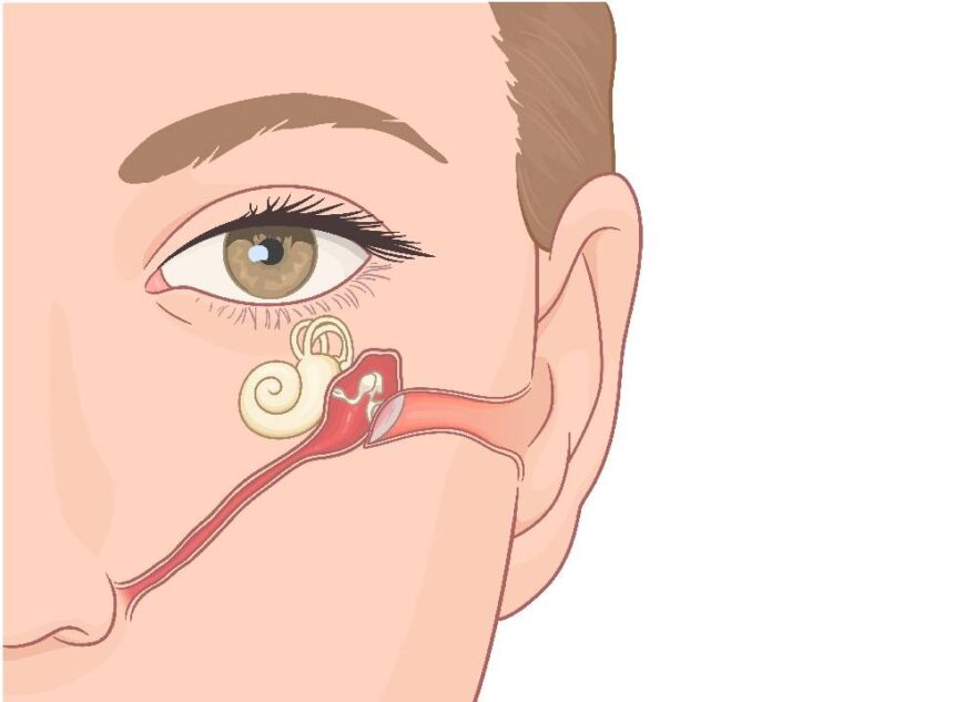 Reasons To Schedule a Balloon Sinuplasty Treatment