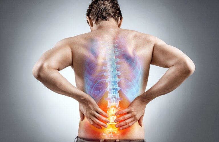 The Benefits of Spine Surgery