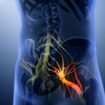 The Connection Between Leg Pain and Sciatica