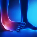 The Importance of Proper Treatment for Ankle Sprains