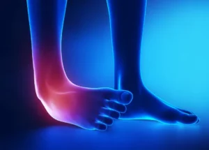 The Importance of Proper Treatment for Ankle Sprains