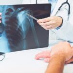 The Role of DEXA Scans in Preventative Healthcare for Older Adults