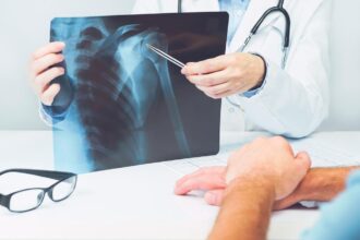 The Role of DEXA Scans in Preventative Healthcare for Older Adults