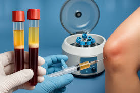 The Role of Stem Cell Therapy in Regenerative Medicine