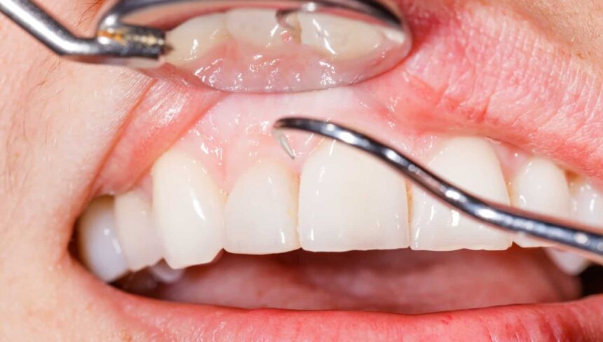 Understanding the Importance of Gum Treatments in Dental Care