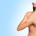 What Are the Benefits of a Breast Lift?