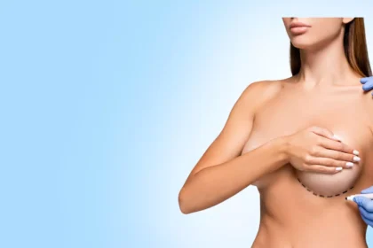 What Are the Benefits of a Breast Lift?
