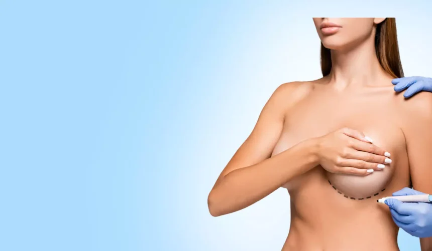 What Are the Benefits of a Breast Lift?