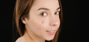 What Causes Lipomas and When Should You See a Dermatologist?