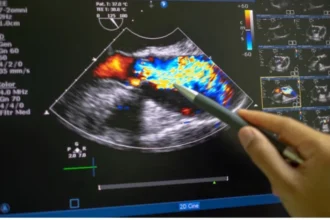 What to Expect During an Echocardiogram