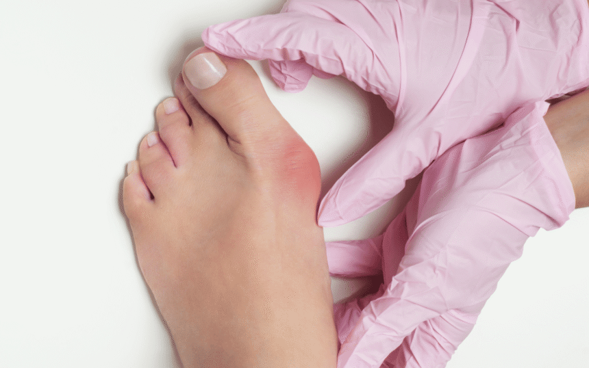 When To Seek Treatment for Bunions