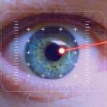 Why Laser Cataract Surgery Is a Game-Changer for Restoring Clear Vision