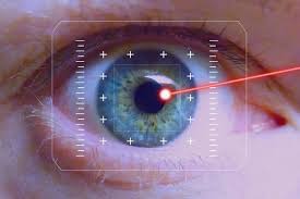 Why Laser Cataract Surgery Is a Game-Changer for Restoring Clear Vision