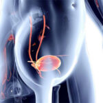 Why Would You Be Referred to Oncology?