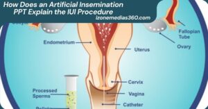 How Does an Artificial Insemination PPT Explain the IUI Procedure